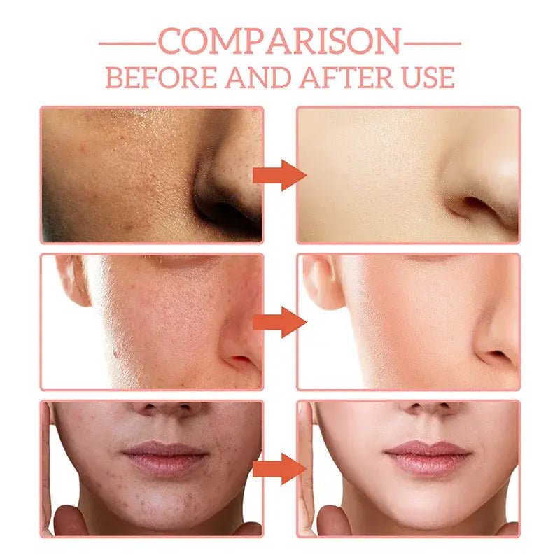 Advanced Skincare Serum - PhysioCare