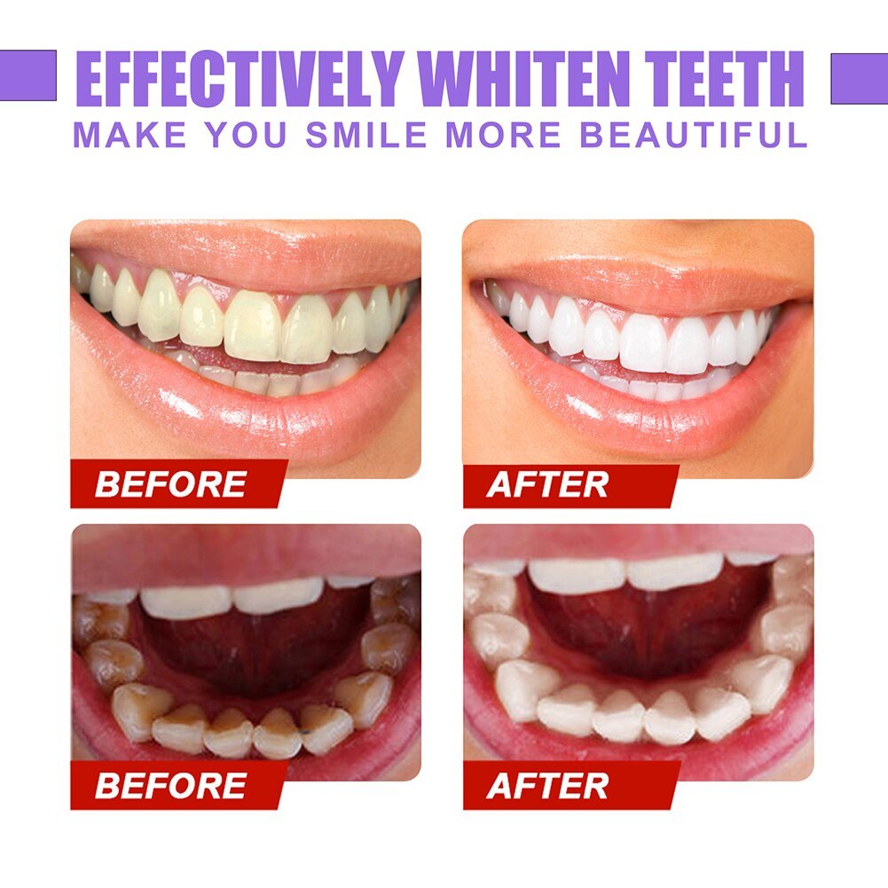 InstaWhite® - Premium Teeth Whitening Serum - PhysioCare