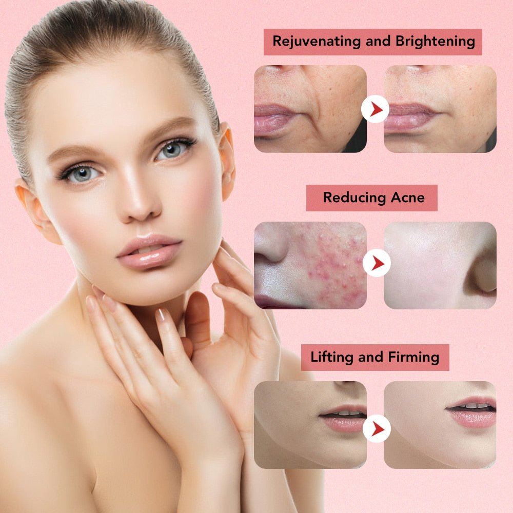 PhysioCare® Aurora: Premium Anti-Aging & Skin Rejuvenating Handset - PhysioCare