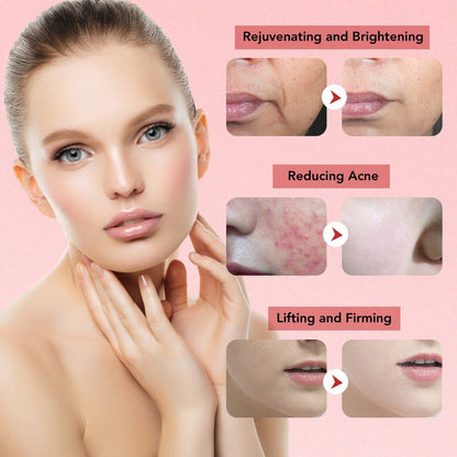 PhysioCare® Aurora: Premium Anti-Aging & Skin Rejuvenating Handset - PhysioCare