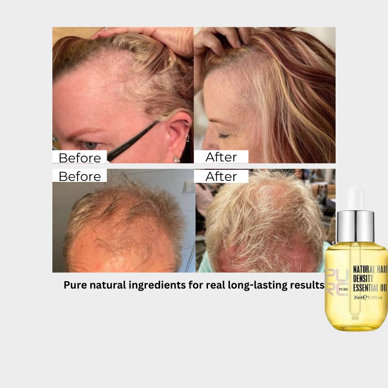 Scalp Hair Growth Oil - PhysioCare