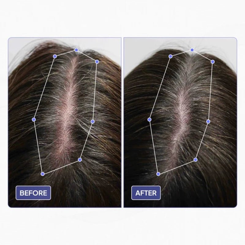 Scalp Hair Growth Oil - PhysioCare
