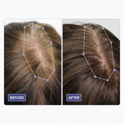 TheraBrush®- Premium Hair Growth Brush - PhysioCare